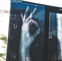 Disability insurance - ramzanmagomedov.com